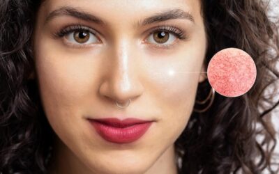 Cera naczynkowa jak dbać o skórę wrażliwą na czynniki zewnętrzne?