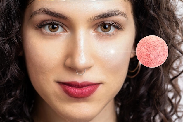 Cera naczynkowa jak dbać o skórę wrażliwą na czynniki zewnętrzne?