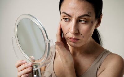 Ślady po trądziku jak się pozbyć niechcianych zmian?