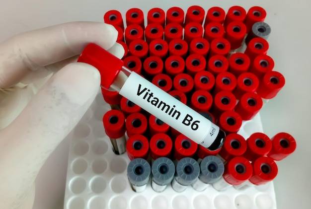 Jakie witaminy na podniesienie hemoglobiny warto rozważyć?